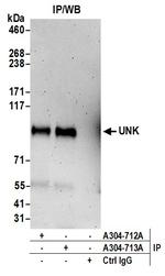 UNK Polyclonal Antibody