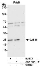 GAS41 Antibody in Immunoprecipitation (IP)