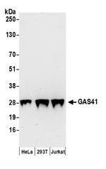 GAS41 Polyclonal Antibody