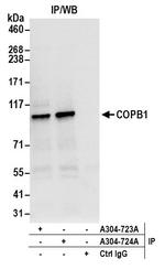 COPB1 Antibody in Immunoprecipitation (IP)