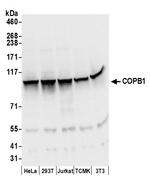 COPB1 Polyclonal Antibody