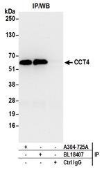 CCT4 Antibody in Immunoprecipitation (IP)
