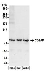 CD2AP Polyclonal Antibody