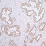 CCT7 Polyclonal Antibody