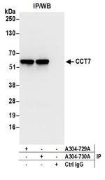 CCT7 Antibody in Immunoprecipitation (IP)