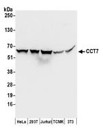 CCT7 Polyclonal Antibody