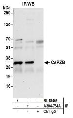 CAPZB Antibody in Immunoprecipitation (IP)