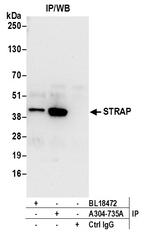 STRAP Antibody in Immunoprecipitation (IP)