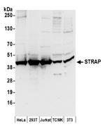STRAP Polyclonal Antibody