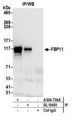 FBP11 Antibody in Immunoprecipitation (IP)
