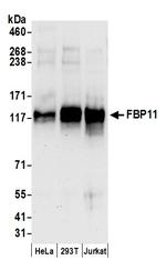FBP11 Polyclonal Antibody