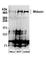Midasin Polyclonal Antibody