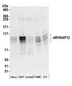 ARHGAP12 Polyclonal Antibody