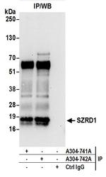 SZRD1 Antibody in Immunoprecipitation (IP)