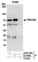 PRKCSH Antibody in Immunoprecipitation (IP)