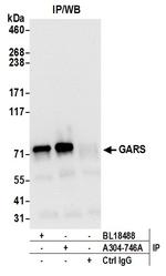 GARS Antibody in Immunoprecipitation (IP)