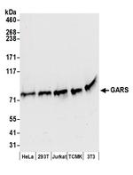 GARS Polyclonal Antibody