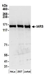 IARS Polyclonal Antibody