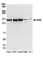IARS Polyclonal Antibody