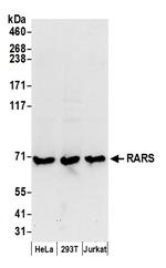 RARS Polyclonal Antibody