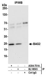 BAG2 Antibody in Immunoprecipitation (IP)