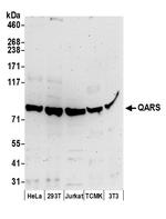 QARS Polyclonal Antibody