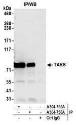 TARS Antibody in Immunoprecipitation (IP)