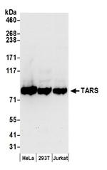 TARS Polyclonal Antibody