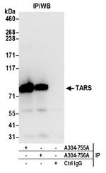 TARS Antibody in Immunoprecipitation (IP)