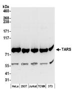 TARS Polyclonal Antibody