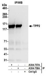 TPP2 Antibody in Immunoprecipitation (IP)