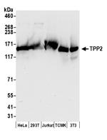 TPP2 Polyclonal Antibody