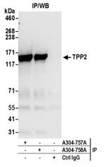 TPP2 Polyclonal Antibody