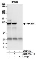 SEC24C Antibody in Immunoprecipitation (IP)