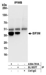 EIF3M Antibody in Immunoprecipitation (IP)