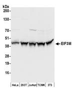 EIF3M Polyclonal Antibody