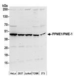 PPME1/PME-1 Polyclonal Antibody