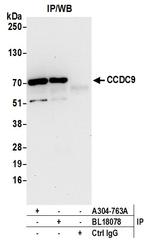 CCDC9 Polyclonal Antibody