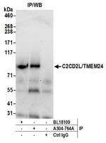 C2CD2L/TMEM24 Antibody in Immunoprecipitation (IP)