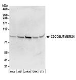 C2CD2L/TMEM24 Polyclonal Antibody