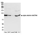 alpha Actinin 4/ACTN4 Polyclonal Antibody