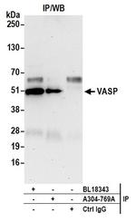VASP Antibody in Immunoprecipitation (IP)