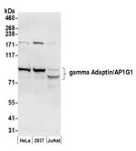 gamma Adaptin/AP1G1 Polyclonal Antibody