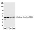 Carbonyl Reductase 1/CBR1 Polyclonal Antibody
