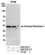 Carbonyl Reductase 1/CBR1 Antibody in Immunoprecipitation (IP)