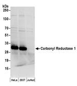 Carbonyl Reductase 1/CBR1 Polyclonal Antibody