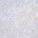 ELAC2 Polyclonal Antibody