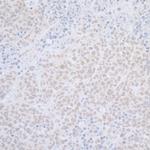 ELAC2 Polyclonal Antibody