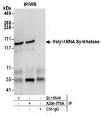 Valyl-tRNA Synthetase/VARS Antibody in Immunoprecipitation (IP)
