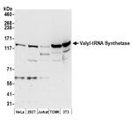 Valyl-tRNA Synthetase/VARS Antibody in Western Blot (WB)